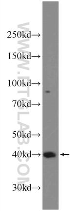 SETD8 Antibody in Western Blot (WB)