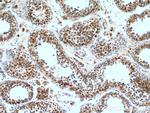 CCP1 Antibody in Immunohistochemistry (Paraffin) (IHC (P))