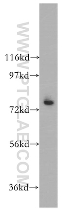 ARID3A Antibody in Western Blot (WB)