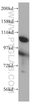 INTS5 Antibody in Western Blot (WB)