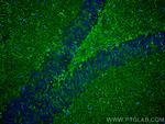 PDGFD Antibody in Immunohistochemistry (PFA fixed) (IHC (PFA))