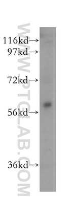 AMIGO2 Antibody in Western Blot (WB)