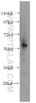 AMIGO2 Antibody in Western Blot (WB)