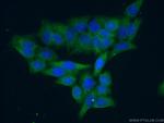 UBE2R2 Antibody in Immunocytochemistry (ICC/IF)