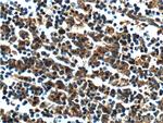 UBE2R2 Antibody in Immunohistochemistry (Paraffin) (IHC (P))