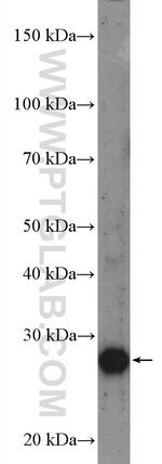 UBE2R2 Antibody in Western Blot (WB)