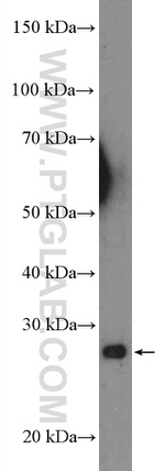 UBE2R2 Antibody in Western Blot (WB)