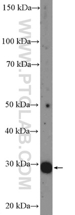 UBE2R2 Antibody in Western Blot (WB)