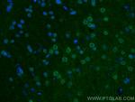Kv1.3 Antibody in Immunohistochemistry (PFA fixed) (IHC (PFA))