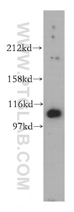 MORC1 Antibody in Western Blot (WB)