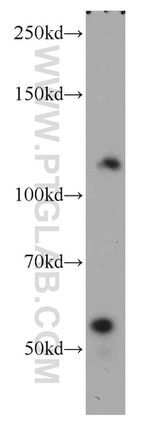 MORC1 Antibody in Western Blot (WB)