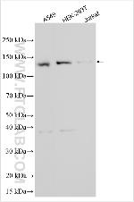 TSSK6 Antibody in Western Blot (WB)