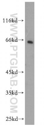 CNKSR3 Antibody in Western Blot (WB)