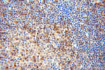DOK2 Antibody in Immunohistochemistry (Paraffin) (IHC (P))