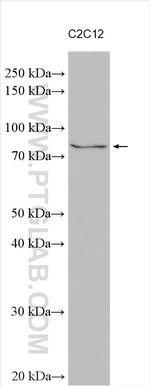 SLC5A11 Antibody in Western Blot (WB)