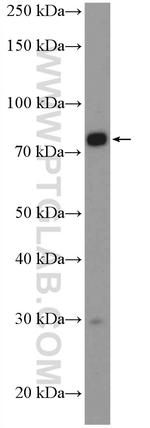 SLC5A11 Antibody in Western Blot (WB)