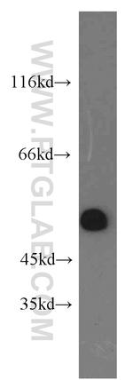 IRGC Antibody in Western Blot (WB)