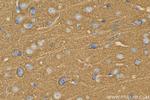 SNAP91 Antibody in Immunohistochemistry (Paraffin) (IHC (P))