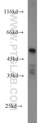 HTRA4 Antibody in Western Blot (WB)