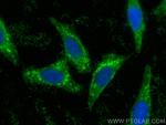 ASAP3 Antibody in Immunocytochemistry (ICC/IF)