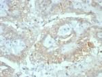 Crystallin Alpha B Monoclonal Antibody (CRYAB/7918)