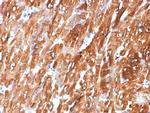 Crystallin Alpha B Antibody in Immunohistochemistry (Paraffin) (IHC (P))