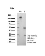 Crystallin Alpha B Antibody in SDS-PAGE (SDS-PAGE)
