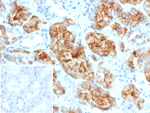 Crystallin Alpha B/CRYAB (Marker of Metaplastic Carcinoma) Recombinant Mouse Monoclonal Antibody (rG2JF)