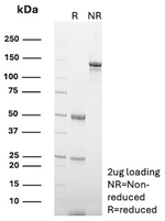 Crystallin Alpha B/CRYAB (Marker of Metaplastic Carcinoma) Antibody in SDS-PAGE (SDS-PAGE)