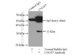 CNOT7 Antibody in Immunoprecipitation (IP)
