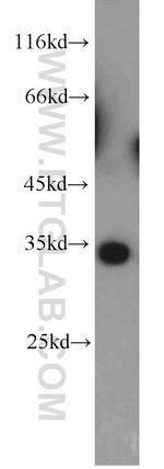 CNOT7 Antibody in Western Blot (WB)