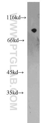 ARNT/HIF1B Antibody in Western Blot (WB)