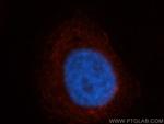 NAPB Antibody in Immunocytochemistry (ICC/IF)