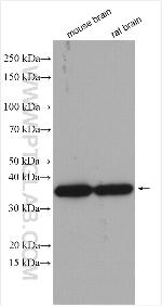 NAPB Antibody in Western Blot (WB)