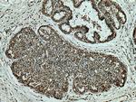 SEPHS2 Antibody in Immunohistochemistry (Paraffin) (IHC (P))