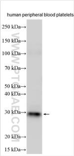 POLG Antibody in Western Blot (WB)