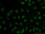 FOXR2 Antibody in Immunocytochemistry (ICC/IF)