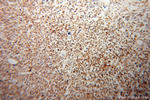 ATP5J Antibody in Immunohistochemistry (Paraffin) (IHC (P))