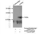 ATP5J Antibody in Immunoprecipitation (IP)