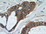 UBE2S Antibody in Immunohistochemistry (Paraffin) (IHC (P))