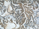 UBE2S Antibody in Immunohistochemistry (Paraffin) (IHC (P))