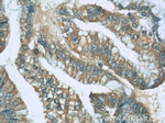 UBE2S Antibody in Immunohistochemistry (Paraffin) (IHC (P))