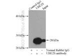 UBE2S Antibody in Immunoprecipitation (IP)