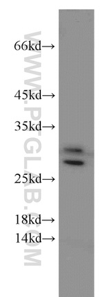 UBE2S Antibody in Western Blot (WB)