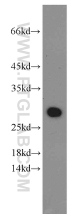 UBE2S Antibody in Western Blot (WB)