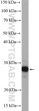 UBE2S Antibody in Western Blot (WB)