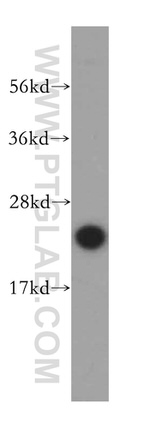 UBE2S Antibody in Western Blot (WB)