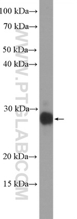UBE2S Antibody in Western Blot (WB)