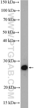 UBE2S Antibody in Western Blot (WB)