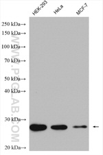 UBE2S Antibody in Western Blot (WB)